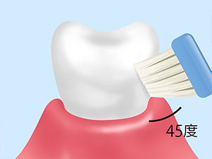 正しく磨けるようにブラッシング指導